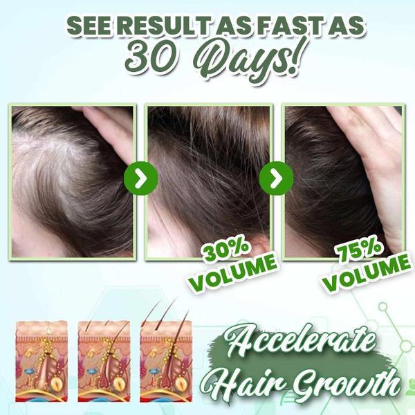 Herbal Hair-Growth Essence Spray