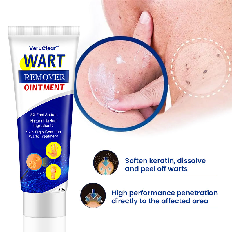 【Limited Stock Available】VeruClear™ Wart Remover Ointment