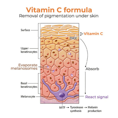 【Limited Time Offer】FreckleAway™ Vitamin C Freckle Removal Gel