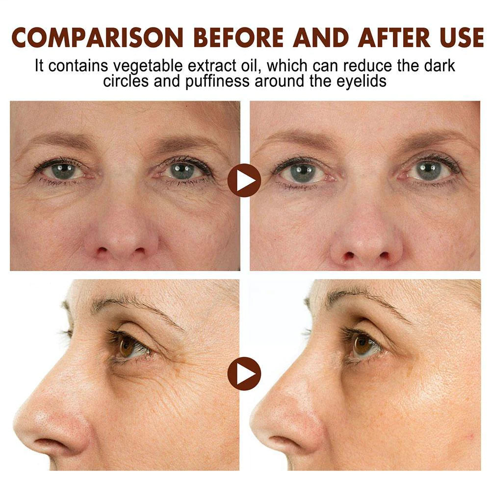【Limited Stock Available】Eyliss™ Crocodile Oil Anti-Aging Eye Cream