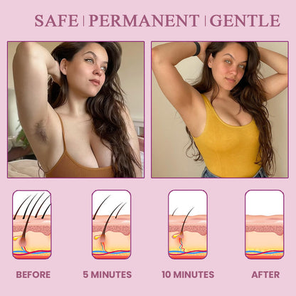 Silkee™ Intimate Hair Removal Cream