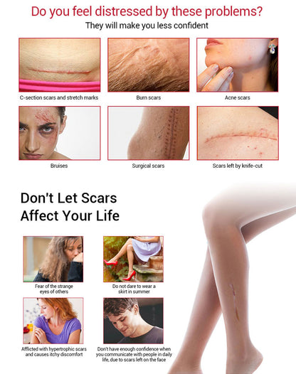 【Limited Time Offer】Scar Removal Gel Ointment