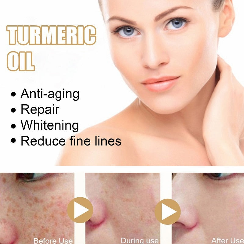 TurmaX™ Turmeric Spot Correcting Serum